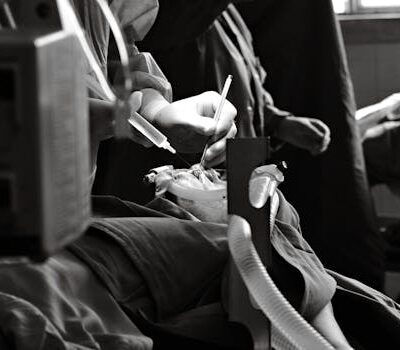 Beyond the Haze: Navigating the Nuances of Post-Surgical Comfort