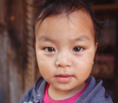 Unlocking Comfort: Your Expert Guide on How to Treat Sensitive Skin